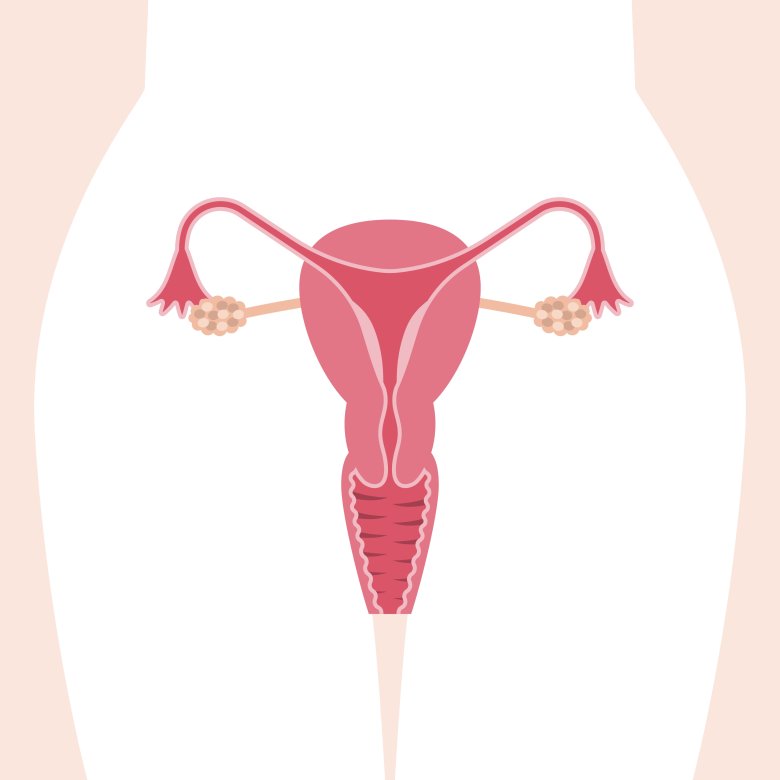 Økt risiko for endometriose hos barn født ved prøverørsbehandling