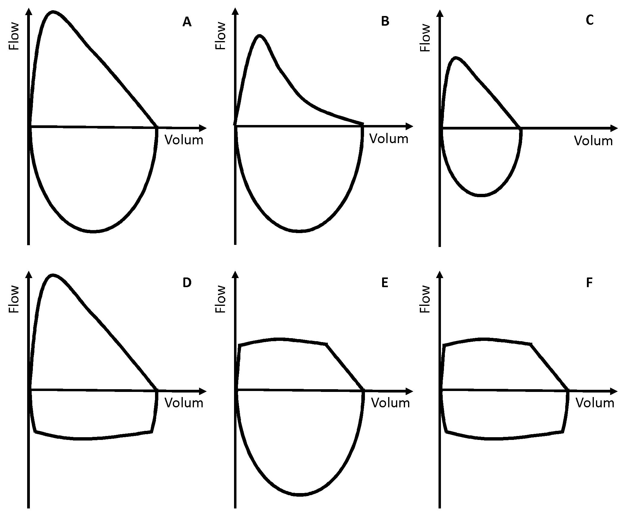 Spirometri_eksempel